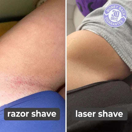 SILK SMOOTH™ - Laser Hair Remover (90% OFF TODAY ONLY!) - netstar
